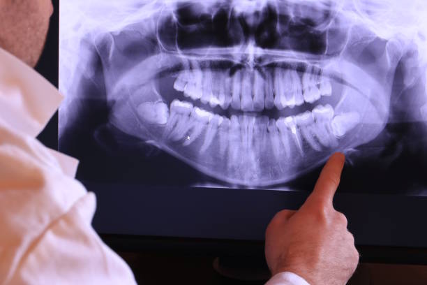 Best Pediatric Emergency Dentist in North Decatur, GA