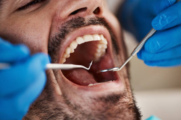 Best Emergency Treatment for Toothache in North Decatur, GA