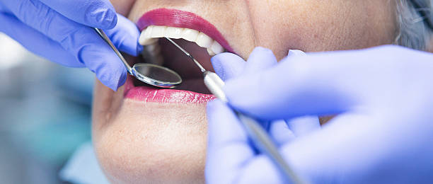 Best Emergency Root Canal Treatment in North Decatur, GA